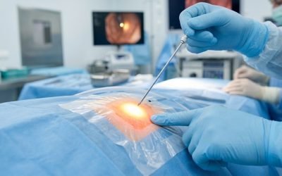 A surgeon's gloved hands inserting a needle into a patient's prepped abdomen during a PEG tube placement, with a bright light illuminating the surgical site and monitors showing the endoscopic view inside the stomach.