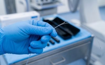 A clinician's blue-gloved hand holding a thin, flexible guidewire with a fine metallic coil tip, used to guide instruments during esophageal stricture dilation procedures.