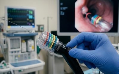 A gloved hand holding a multi-band ligator loaded with black elastic bands on its transparent barrel, the device used to place bands on esophageal varices during EVBL.